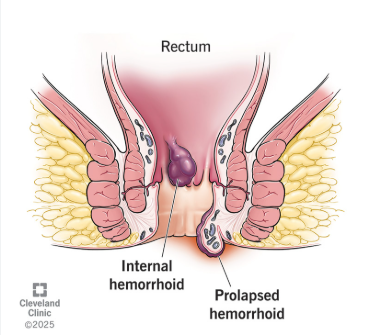 Blog Post Image